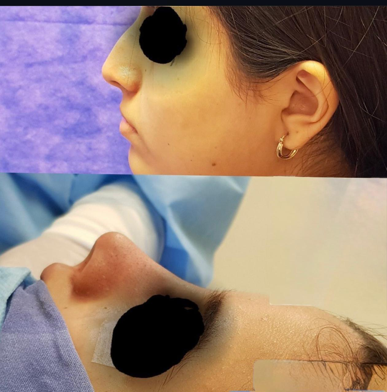 Procedimiento ORL 1 - Caso exitoso